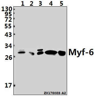 Western blot (WB) analysis of Myf-6 (R150) pAb at 1:1000 dilution
Lane1:THP-1 whole cell lysate(40ug)
Lane2:MG63 whole cell lysate(20ug)
Lane3:PC3 whole cell lysate(10ug)
Lane4:H9C2 whole cell lysate(40ug)
Lane5:SP2/0 whole cell lysate(20ug)