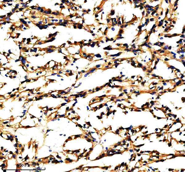  IHC analysis of PXDN using anti-PXDN antibody (A06456-1)