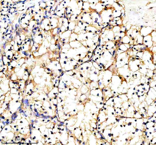  IHC analysis of PXDN using anti-PXDN antibody (A06456-1)