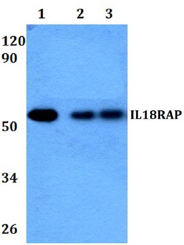 a06457 1 il18rap primary antiboties wb testing 1