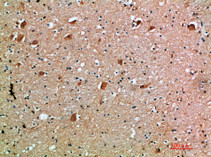a06457 il18rap primary antibodies ihc testing 1
