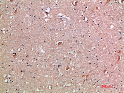 a06457 il18rap primary antibodies ihc testing 2
