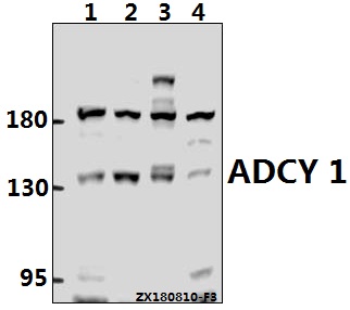 Western blot (WB) analysis of ADCY 1 (D252) Antibody at 1:500 dilution
Lane1:HEK293T whole cell lysate(40ug)
Lane2:MCF-7 whole cell lysate(40ug)
Lane3:C6 whole cell lysate(40ug)
Lane4:AML-12 whole cell lysate(40ug)