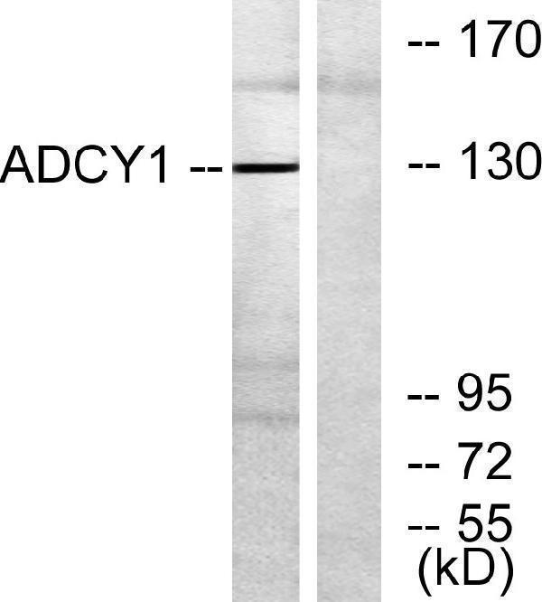 Western blot analysis of lysates from COLO205 cells, using ADCY1 Antibody