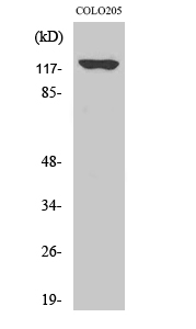 Western Blot analysis of COLO205 cells using A Cyclase I Polyclonal Antibody