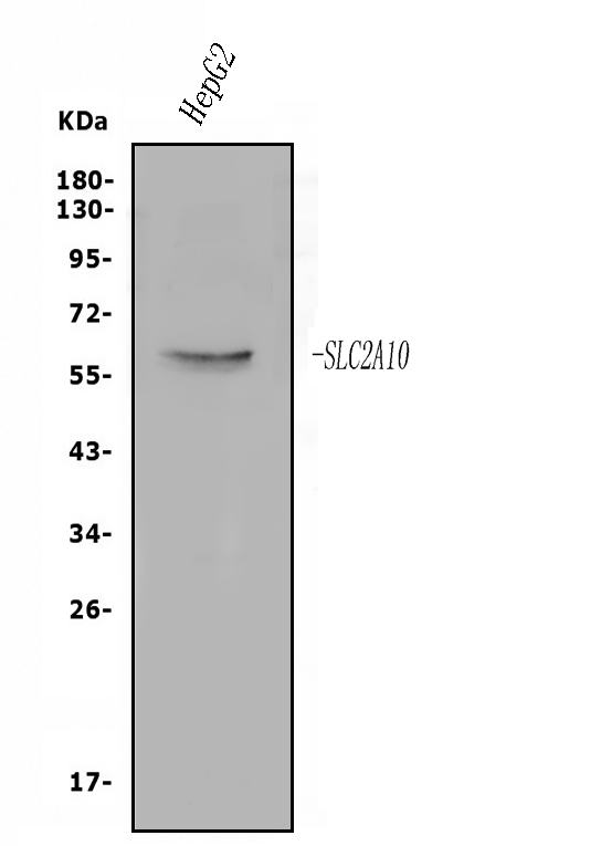 a06461 2 slc2a10 primary antibodies wb testing 1