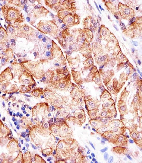 Immunohistochemical analysis of paraffin-embedded H