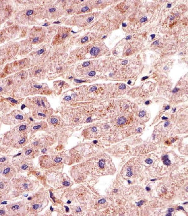 Immunohistochemical analysis of paraffin-embedded H