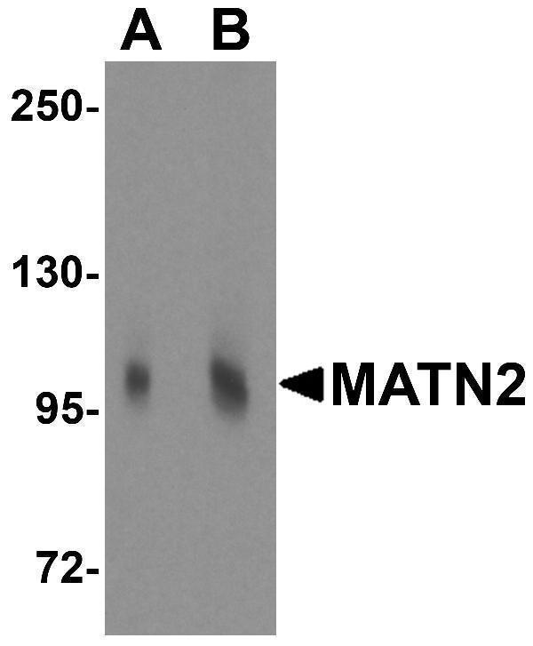 a06462 matn2 primary antibodies wb testing 1