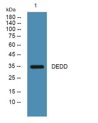 Western blot analysis of lysates from SH-SY5Y cells, primary antibody was diluted at 1:1000, 4°over night