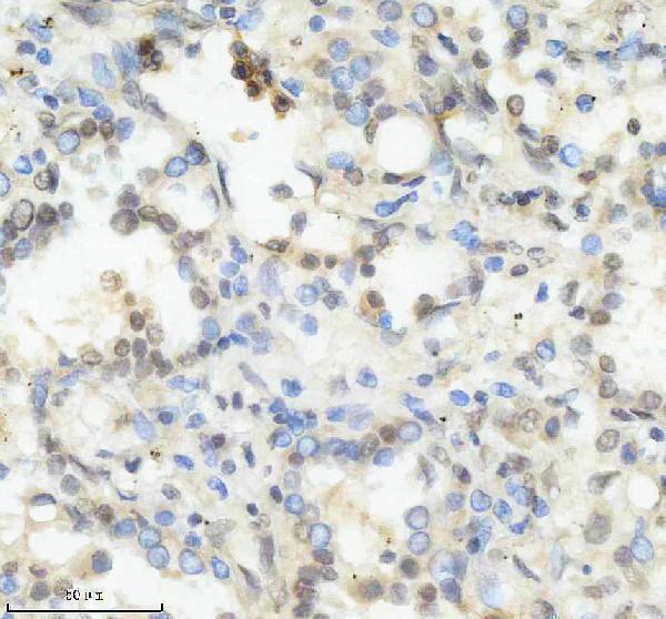 IHC analysis of SMARCD3 using anti-SMARCD3 antibody (A06464-1)