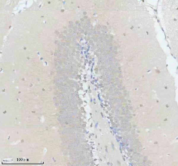 IHC analysis of SMARCD3 using anti-SMARCD3 antibody (A06464-1)