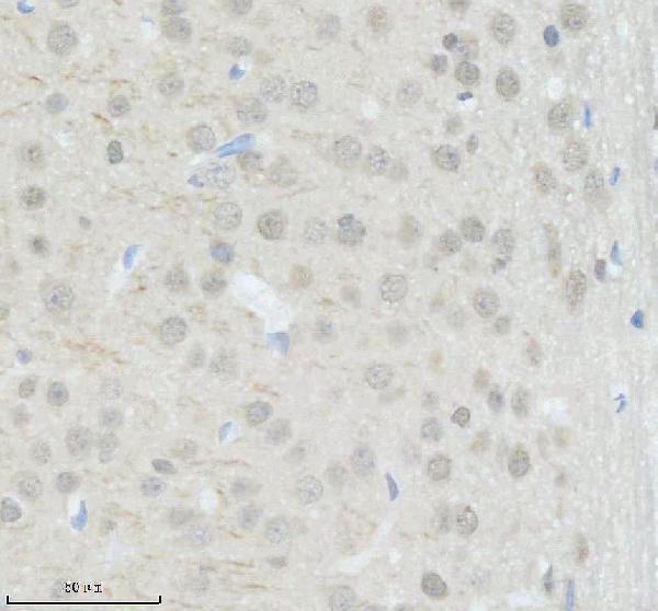 a06464 1 smarcd3 primary antibodies ihc testing 3