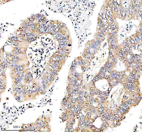 a06465 1 mthfd2 primary antibodies ihc testing 2