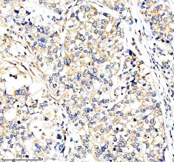 a06465 1 mthfd2 primary antibodies ihc testing 3