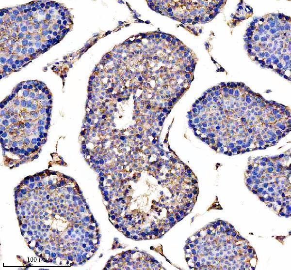 a06465 1 mthfd2 primary antibodies ihc testing 4