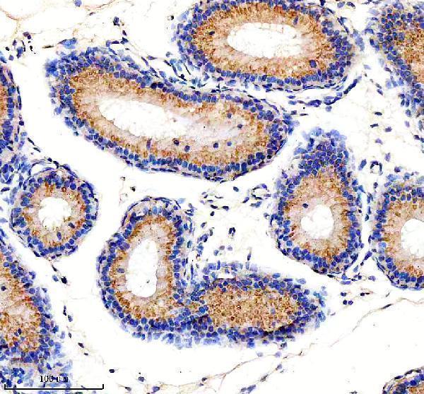 a06465 1 mthfd2 primary antibodies ihc testing 5