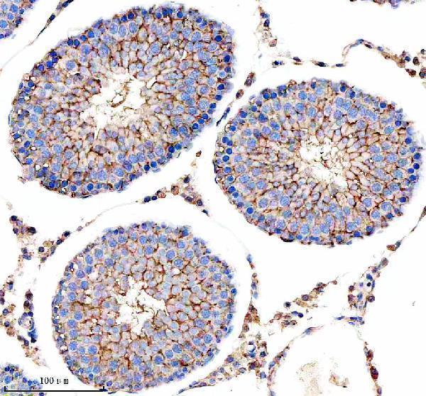 a06465 1 mthfd2 primary antibodies ihc testing 6