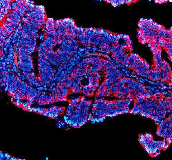 a06466 2 pde6d primary antibodies if testing 1