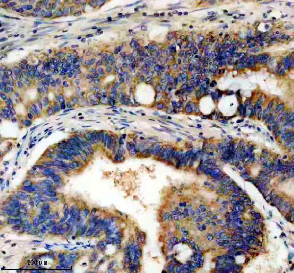 IHC analysis of PDE6D using anti-PDE6D antibody (A06466-2)