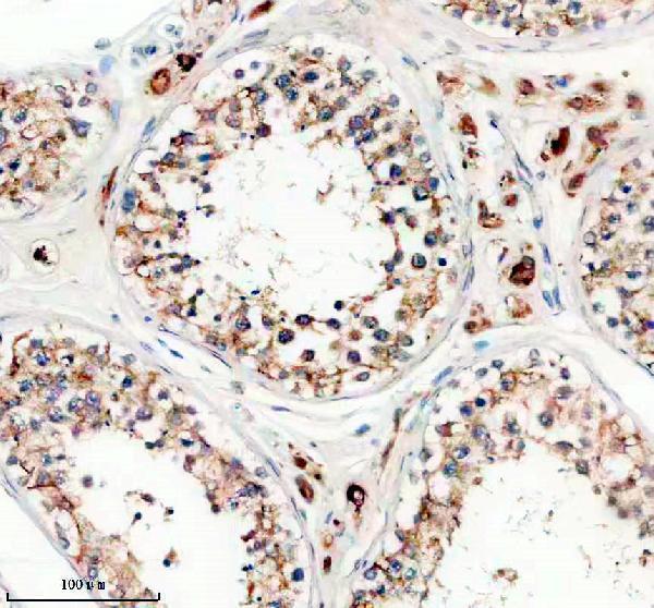 IHC analysis of PDE6D using anti-PDE6D antibody (A06466-2)
