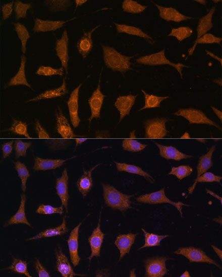 Immunofluorescence analysis of L929 cells using PDE6D Polyclonal Antibody  at dilution of 1:100 