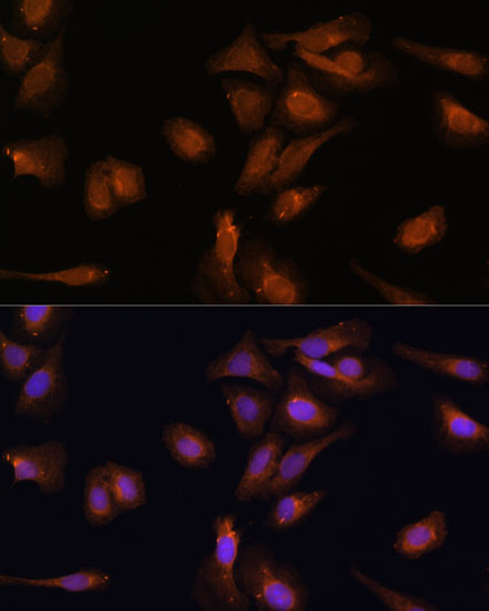 Immunofluorescence analysis of U-2 OS cells using PDE6D Polyclonal Antibody  at dilution of 1:100 