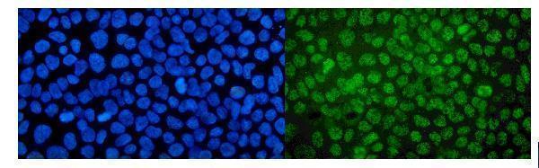 a06467 2 med4 primary antibodies if testing 5