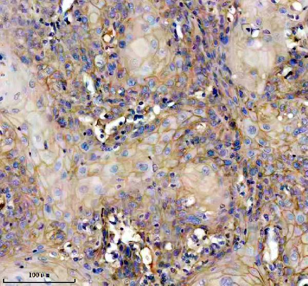 IHC analysis of FGFBP1 using anti-FGFBP1 antibody (A06468-1)
