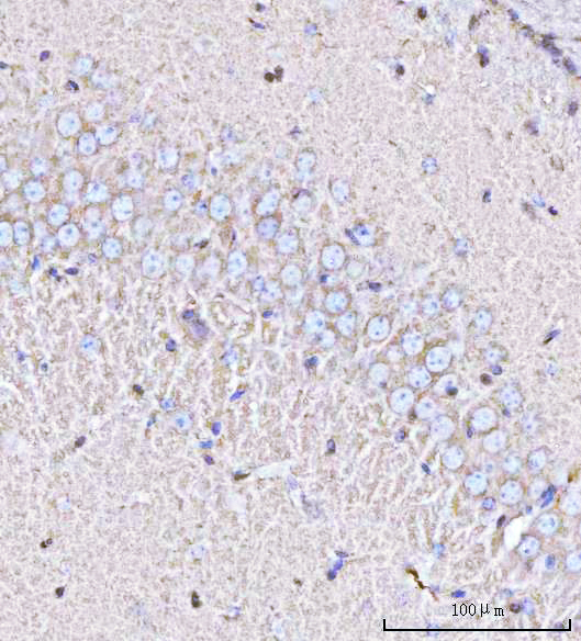  IHC analysis of PPP3R1 using anti-PPP3R1 antibody (A06469-1)