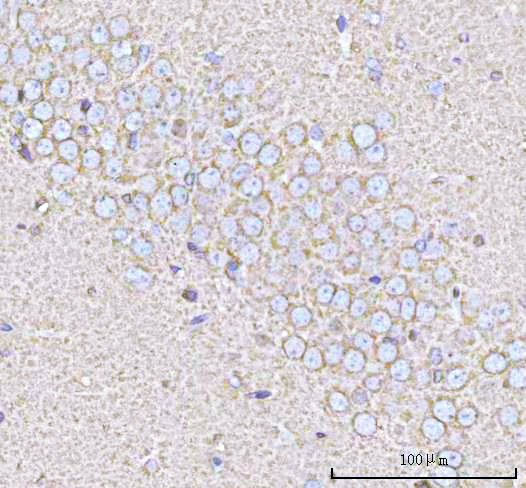  IHC analysis of PPP3R1 using anti-PPP3R1 antibody (A06469-1)