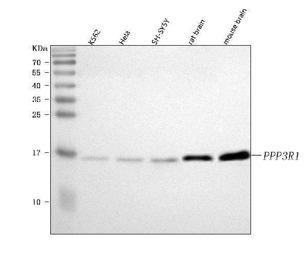  Western blot analysis of PPP3R1 using anti-PPP3R1 antibody (A06469-1)