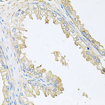 a06469 ppp3r1 primary antiboties if testing 2