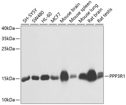 a06469 ppp3r1 primary antiboties wb testing 1
