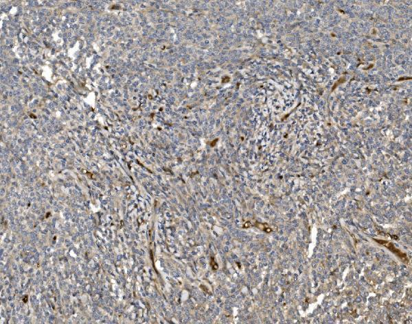  IHC analysis of EIF3C using anti-EIF3C antibody (A06470-1)