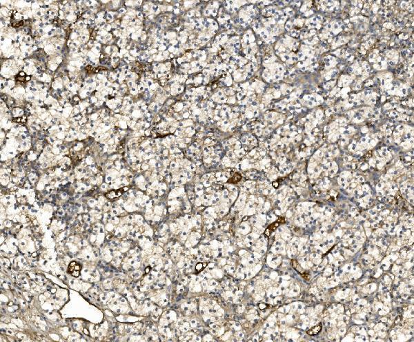 IHC analysis of EIF3C using anti-EIF3C antibody (A06470-1)