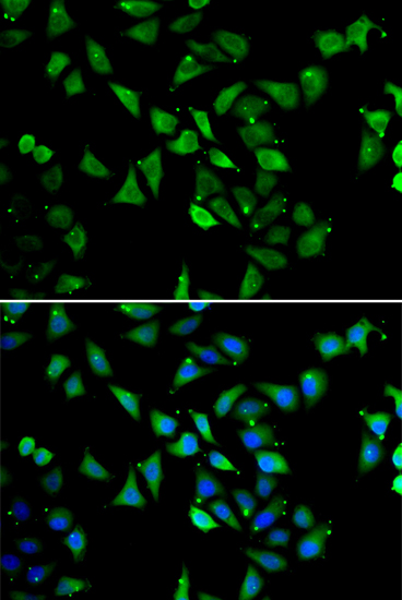 a06470 eif3c primary antiboties ihc testing 2