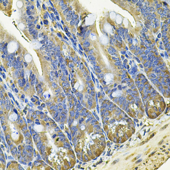 a06470 eif3c primary antiboties ihc testing 3