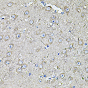 a06470 eif3c primary antiboties ihc testing 4