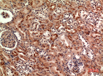 a06475 cer1 primary antibodies ihc testing 1