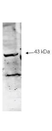 Western blot analysis using Boster Immunochemical
