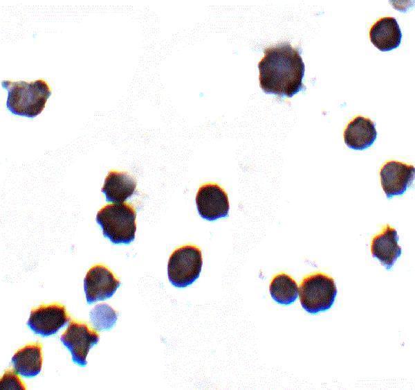 Immunocytochemistry of IQSEC1 in A-20 cells with IQSEC1 antibody at 2 μg/mL