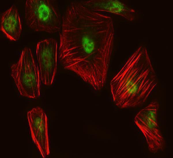  IF analysis of SUPT6H using anti-SUPT6H antibody (A06484-1)