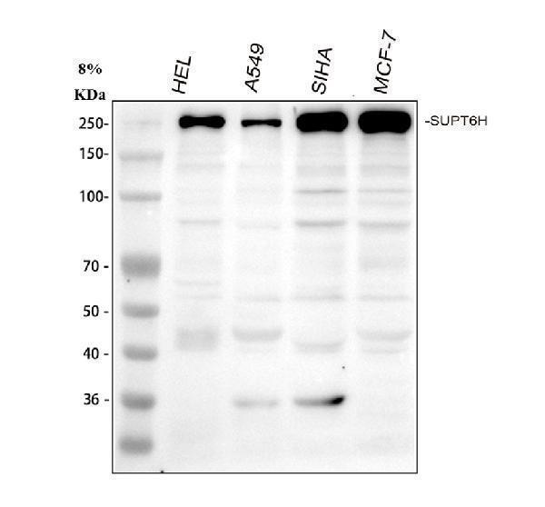  Western blot analysis of SUPT6H using anti-SUPT6H antibody (A06484-1)