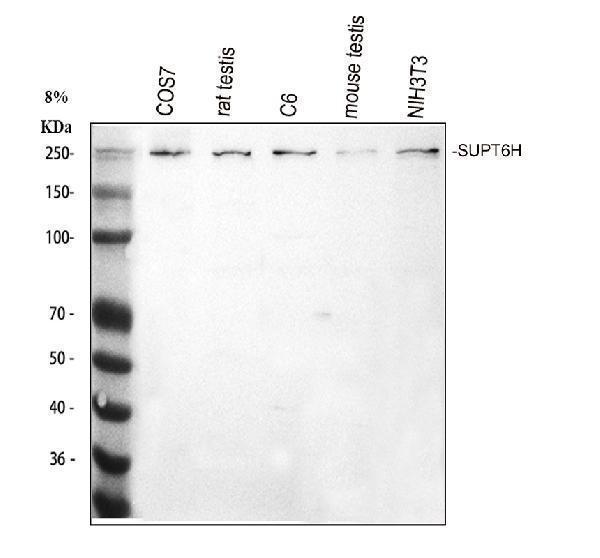  Western blot analysis of SUPT6H using anti-SUPT6H antibody (A06484-1)