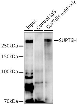 a06484 supt6h primary antiboties ip testing 3