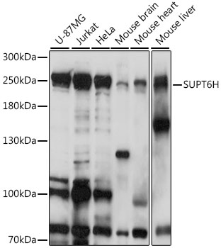 a06484 supt6h primary antiboties wb testing 1