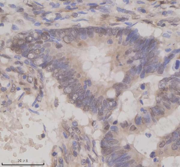 IHC analysis of OAZ1 using anti-OAZ1 antibody (A06486-4)