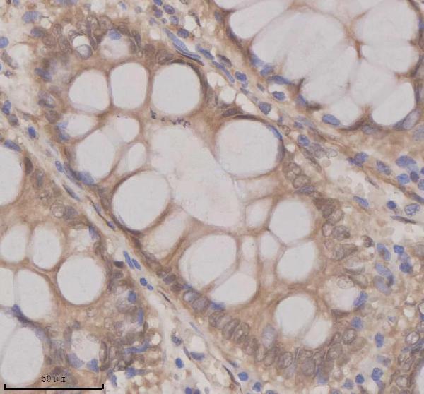 IHC analysis of OAZ1 using anti-OAZ1 antibody (A06486-4)