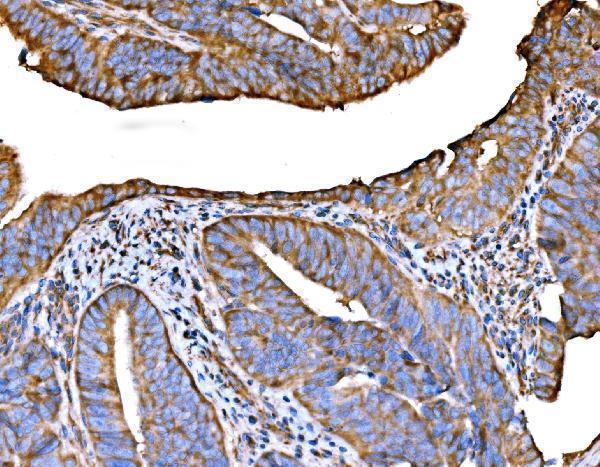  IHC analysis of RPL32 using anti-RPL32 antibody (A06487-1)